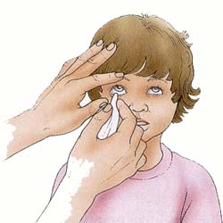 Попадание инородных тел в глаза, уши или нос